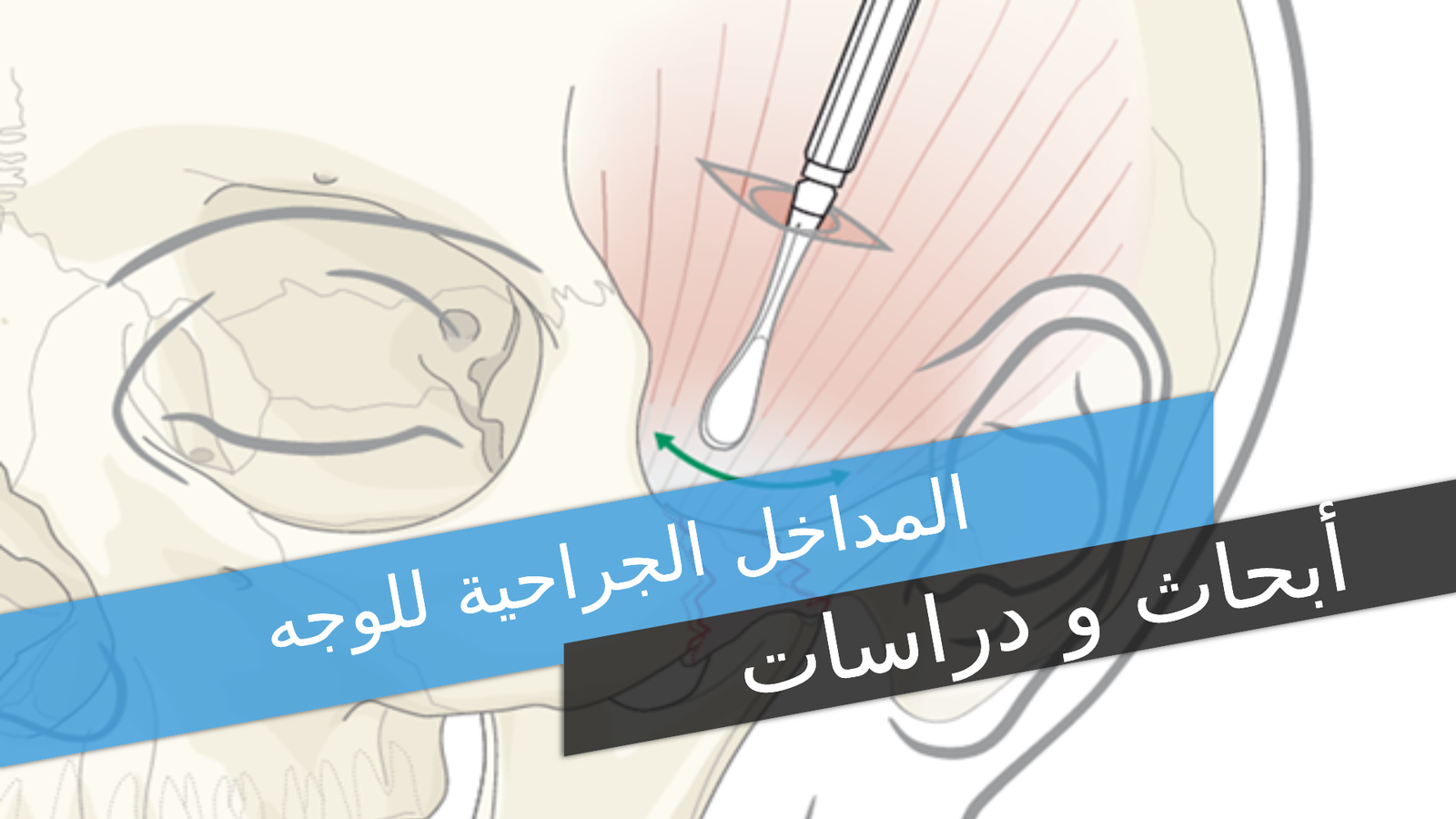 Surgical Approaches to the Facial Skeleton
