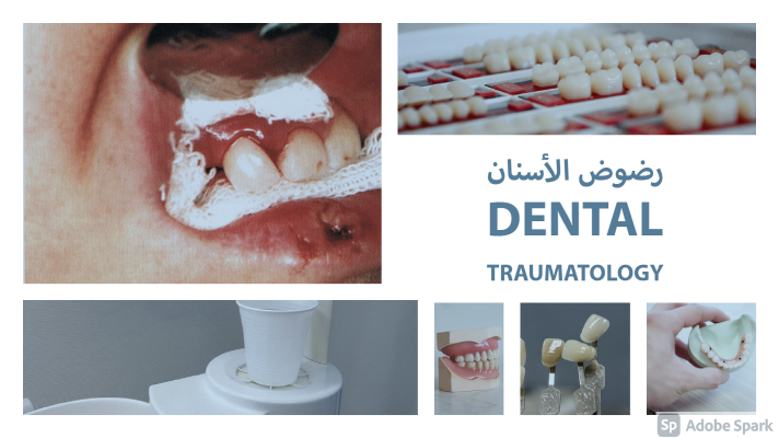 رضوض الأسنان Dental Traumatology